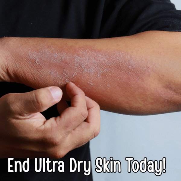 Whipped Shea Butter Cream for Dry Skin - Ultra Hydrating Body Butter